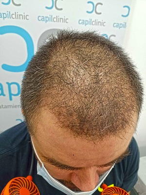 Fotos Pre-operatorias.jpg