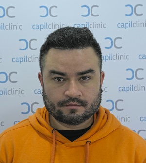 Resultado Final Capilclinic.jpg